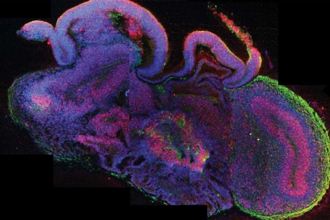 Sección del tejido cerebral generado a partir de células embrionarias.