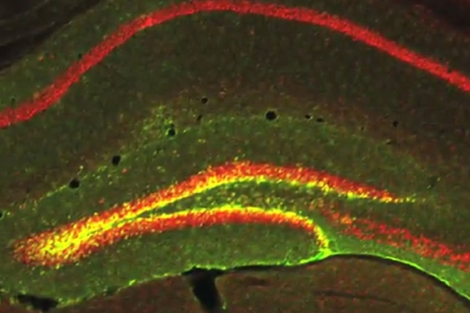 La zona amarilla muestra el nivel de RbAp48 en el cerebro de un ratón.