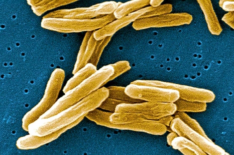 Detalle del bacilo de la tuberculosis bajo el microscopio. | EL MUNDO
