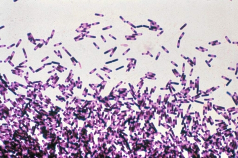 Vista al microscopio de la bacteria 'Clostridium difficile'. | El Mundo
