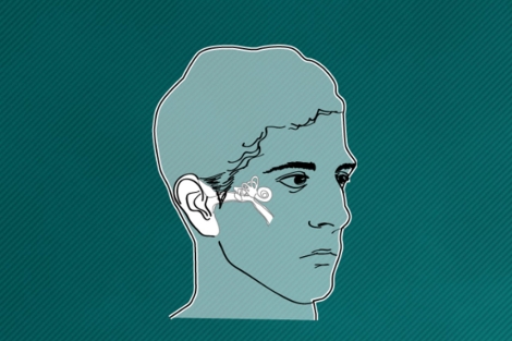 Vea el gráfico sobre la audición y cómo funciona el implante coclear. | Gracia Pablos