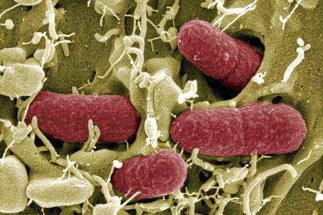 Una cepa de la bacteria 'Escherichia coli'. | Efe