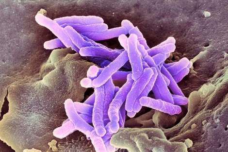 Detalle del bacilo de la tuberculosis , ‘Mycobacterium tuberculosis'
