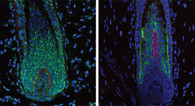 Detalle de la regeneración capilar progresiva. | PNAS