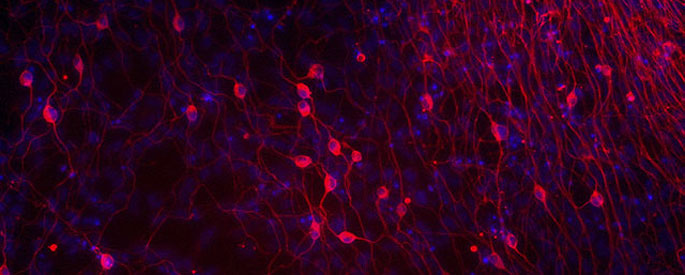 Clulas nerviosas obtenidas a partir de clulas reprogramadas de la piel humana.