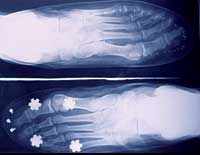 MIRADA DE RAYOS X. En la imagen, radiografas de los pies de un jugador del Ftbol Club Barcelona con las botas de ftbol puestas. A la derecha destaca la colocacin de los tacos y dnde apoyan.