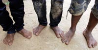 Los pies de los tres esclavos del mar rescatados y devueltos a la aldea camboyana de Dong Khpos, en la frontera con Vietnam.| David Jiménez