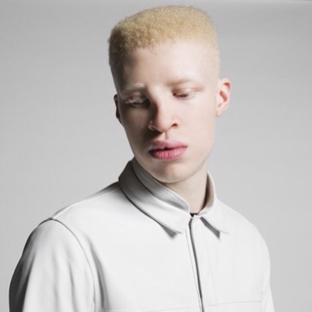 Top 100+ imagen negro albino modelo