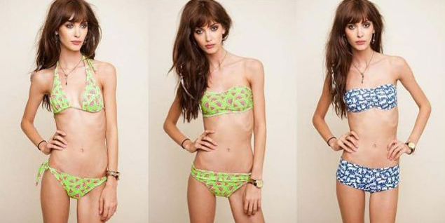 Las modelos delgadas influyen en los casos de anorexia | Moda 